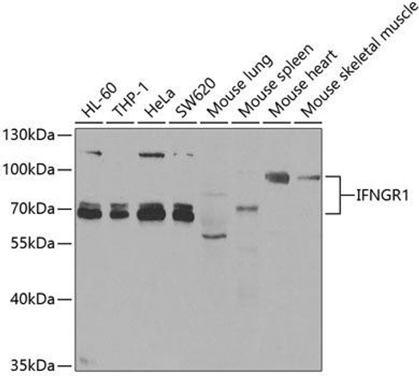 Anti-IFNGR1 Antibody (CAB5748)