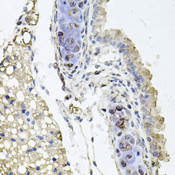 Anti-RHOT1 Antibody (CAB5838)