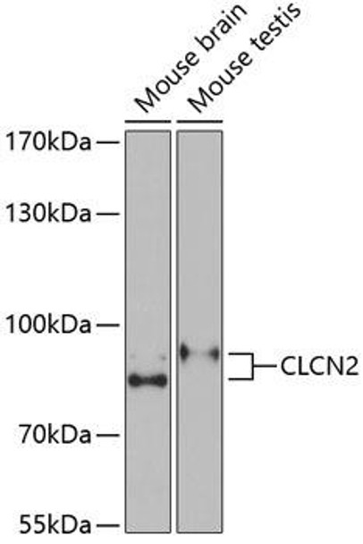 Anti-CLCN2 Antibody (CAB6120)