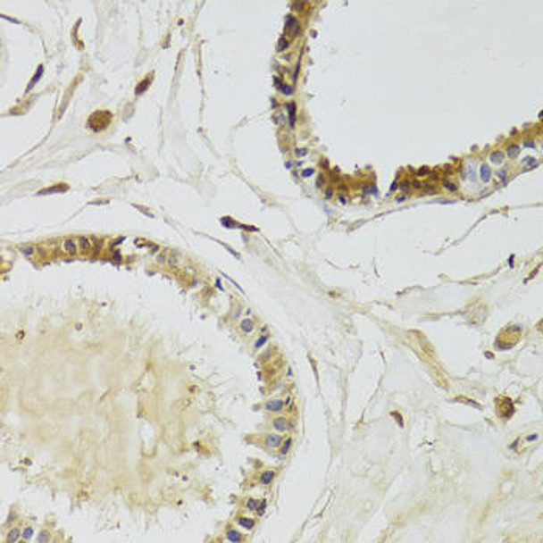 Anti-KLK10 Antibody (CAB6398)