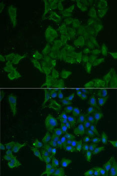 Anti-LGALS3BP Antibody (CAB6929)