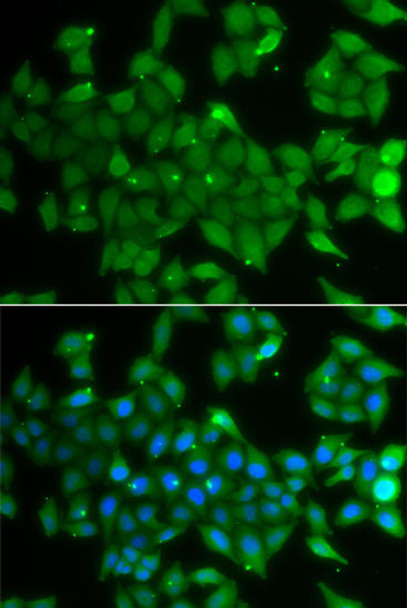 Anti-ANXA11 Antibody (CAB7423)