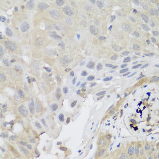 Anti-SH3GLB2 Antibody (CAB7599)