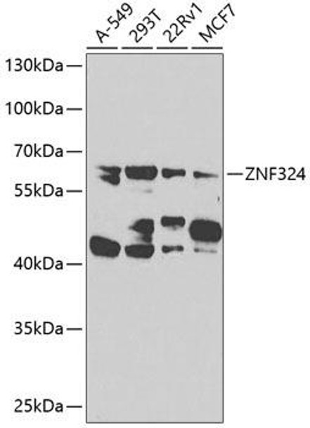 Anti-ZNF324 Antibody (CAB7968)