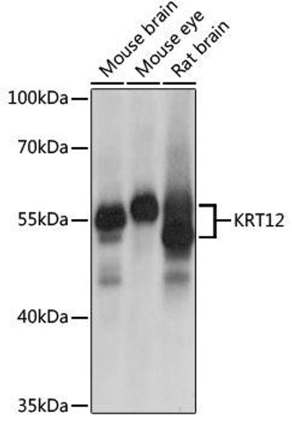 Anti-KRT12 Antibody (CAB9642)