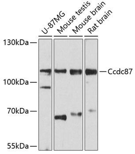 Anti-Ccdc87 Antibody (CAB12021)