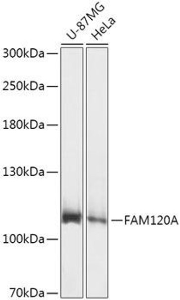 Anti-FAM120A Antibody (CAB17658)