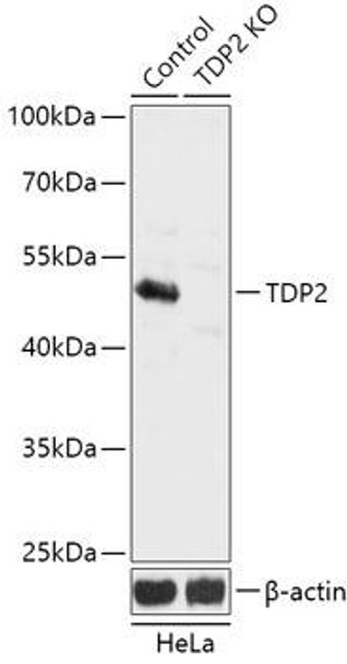 Anti-TDP2 Antibody (CAB18017)[KO Validated]