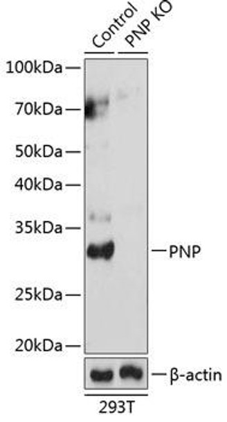 Anti-PNP Antibody (CAB19885)[KO Validated]