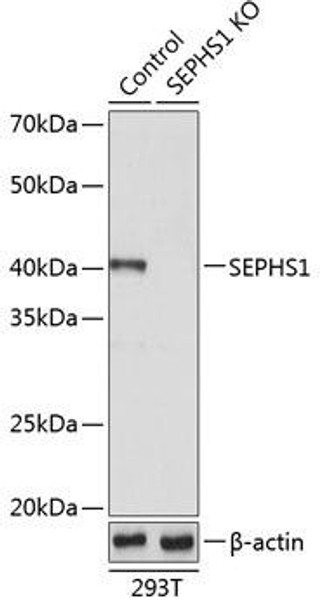 Anti-SEPHS1 Antibody (CAB19920)[KO Validated]