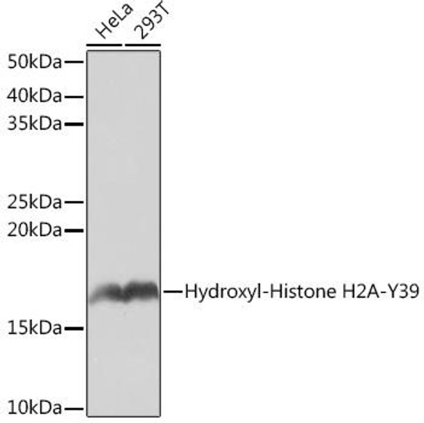 Anti-Hydroxyl-Histone H2A-Y39 Antibody (CAB4827)