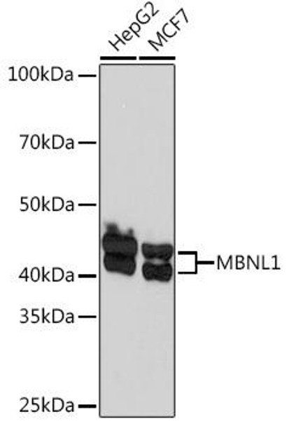 Anti-MBNL1 Antibody (CAB5149)