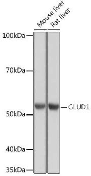 Anti-GLUD1 Antibody (CAB5176)