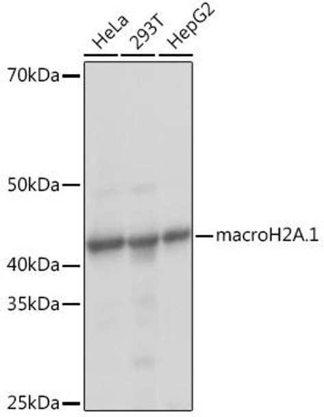 Anti-macroH2A.1 Antibody (CAB9059)