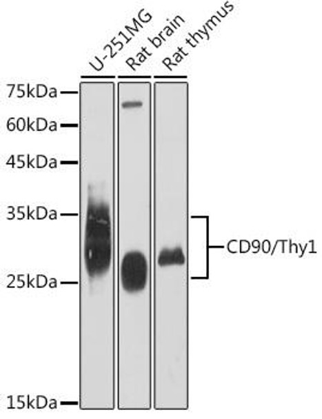 Anti-CD90/Thy1 Antibody (CAB12623)