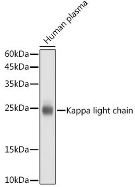 Anti-Kappa light chain Antibody (CAB18740)