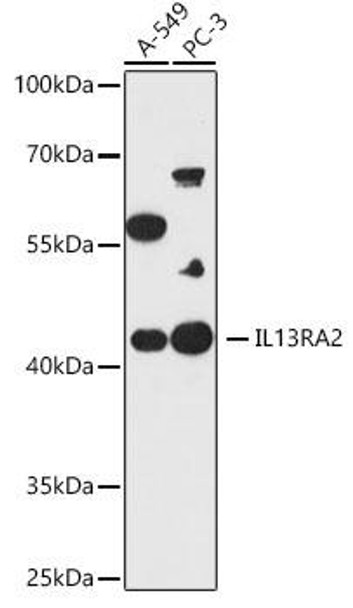 Anti-IL13RA2 Antibody (CAB19318)