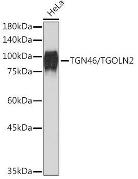 Anti-TGN46/TGOLN2 Antibody (CAB19618)