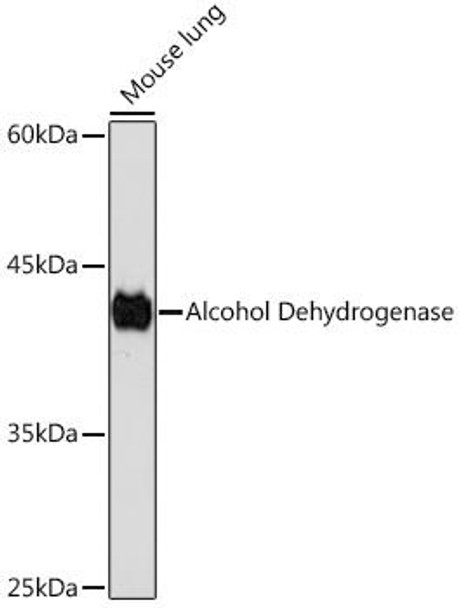 Anti-Alcohol Dehydrogenase Antibody (CAB19624)