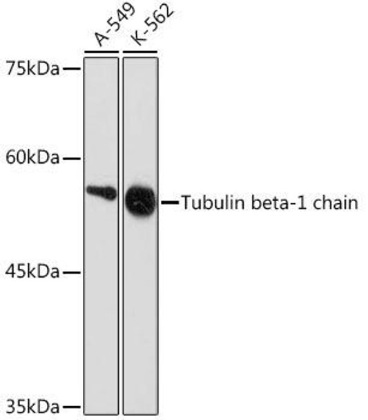 Anti-Tubulin beta-1 chain Antibody (CAB19805)