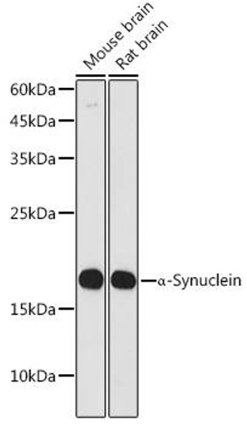 Anti-alpha-Synuclein Antibody (CAB20407)