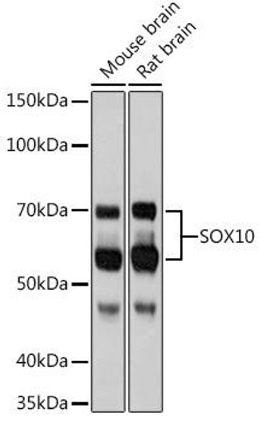 Anti-SOX10 Antibody (CAB8658)