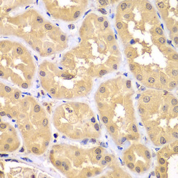 Anti-TRIM69 Antibody (CAB5910)