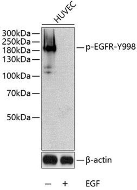 Anti-Phospho-EGFR-Y998 Antibody (CABP0024)