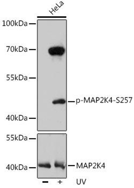 Anti-Phospho-MAP2K4-S257 Antibody (CABP0068)