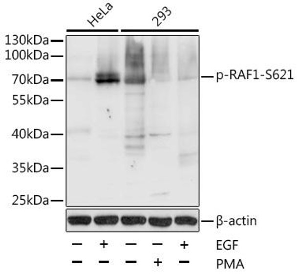Anti-Phospho-RAF1-S621 Antibody (CABP0087)