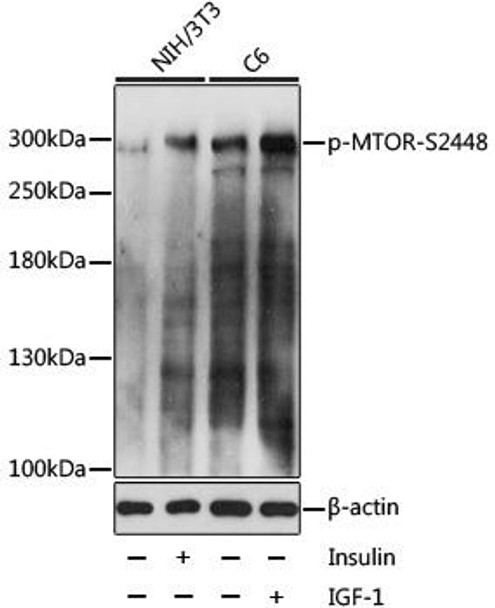 Anti-Phospho-mTOR-S2448 Antibody (CABP0094)