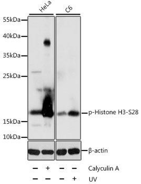 Anti-Phospho-Histone H3-S28 Antibody (CABP0097)