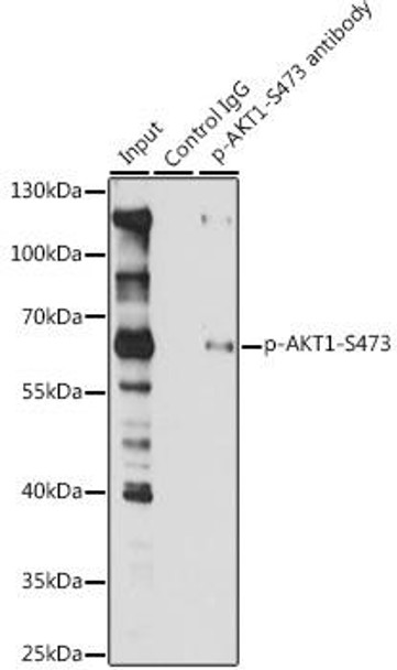 Anti-Phospho-AKT1-S473 Antibody (CABP0098)
