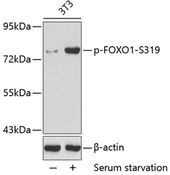 Anti-Phospho-FOXO1-S319 Antibody (CABP0176)