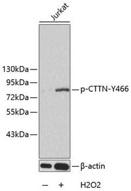 Anti-Phospho-CTTN-Y466 Antibody (CABP0247)