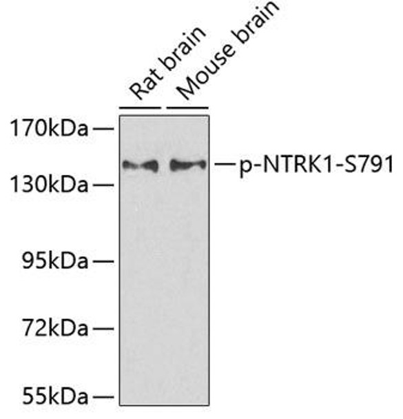 Anti-Phospho-NTRK1-S791 Antibody (CABP0272)