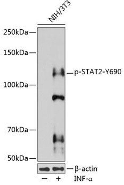 Anti-Phospho-STAT2-Y690 Antibody (CABP0284)