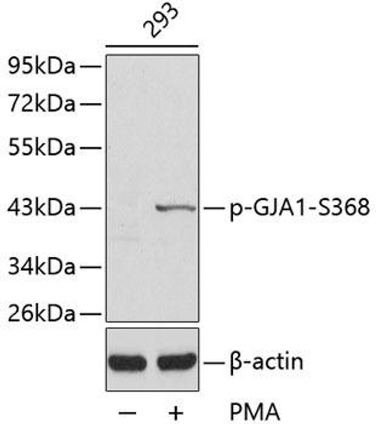 Anti-Phospho-GJA1-S368 Antibody (CABP0355)
