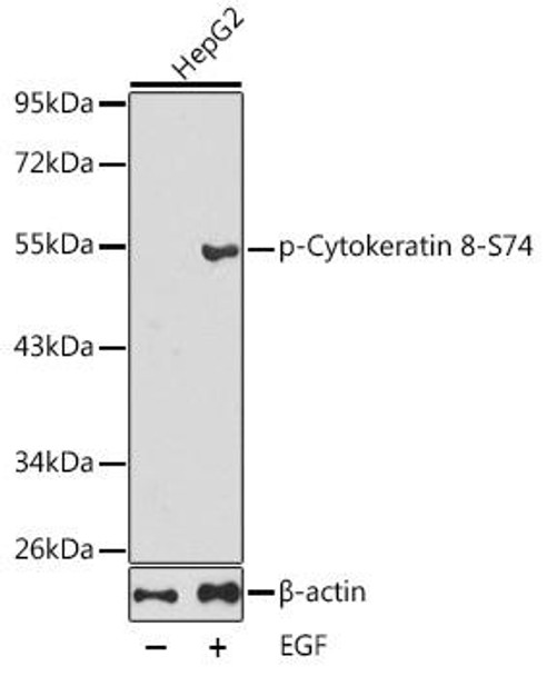 Anti-Phospho-KRT8-S74 Antibody (CABP0386)