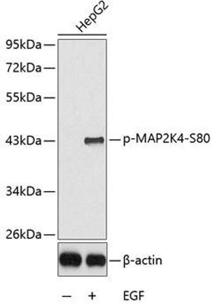 Anti-Phospho-MAP2K4-S80 Antibody (CABP0390)