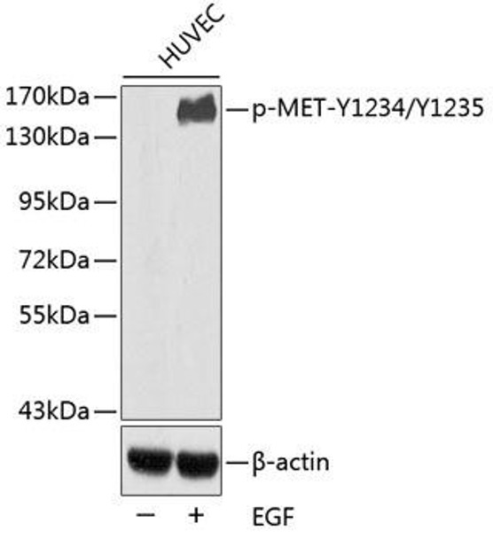 Anti-Phospho-MET-Y1234/Y1235 Antibody (CABP0408)