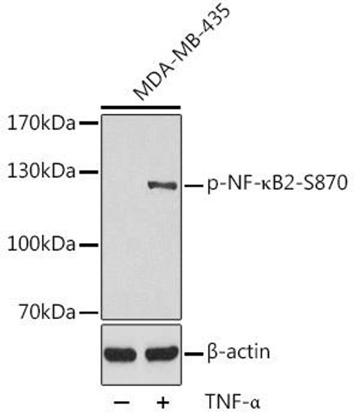 Anti-Phospho-NFKB2-S870 Antibody (CABP0419)