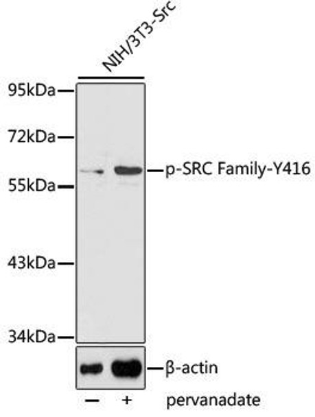 Anti-Phospho-SRC-Y416 Antibody (CABP0480)