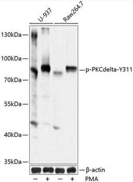 Anti-Phospho-PKCdelta-Y311 Antibody (CABP0496)