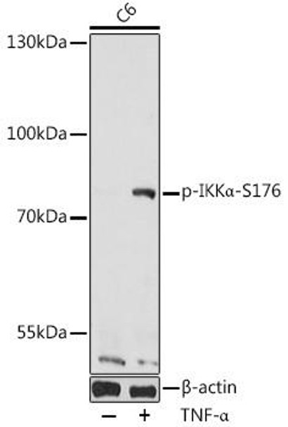 Anti-Phospho-CHUK-S176 Antibody (CABP0505)