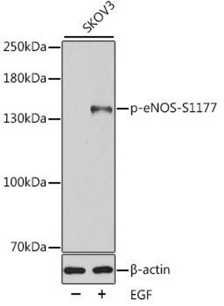 Anti-Phospho-eNOS-S1177 Antibody (CABP0515)