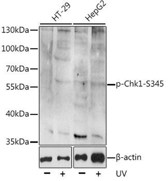Anti-Phospho-CHEK1-S345 Antibody (CABP0578)