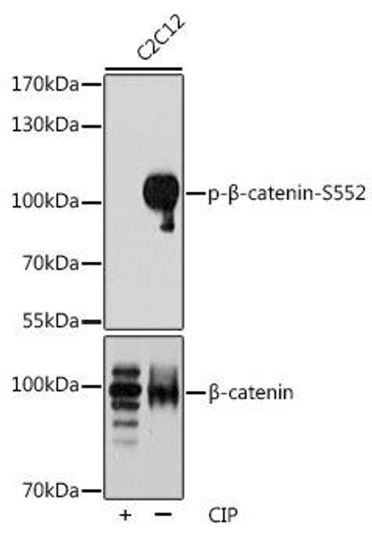 Anti-Phospho-CTNNB1-S552 Antibody (CABP0579)