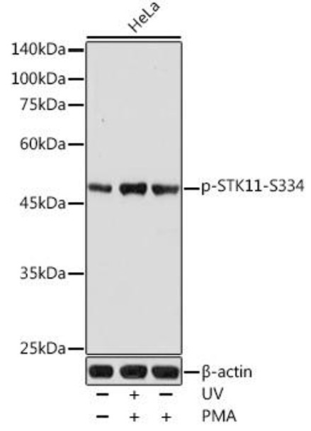 Anti-Phospho-STK11-S334 Antibody (CABP0601)