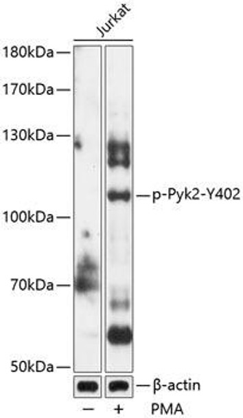 Anti-Phospho-Pyk2-Y402 Antibody (CABP0612)